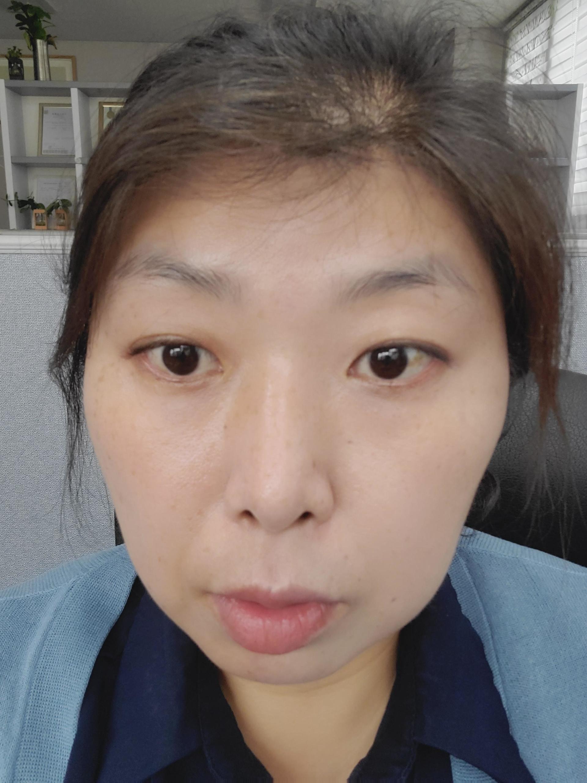 피드이미지정보-7