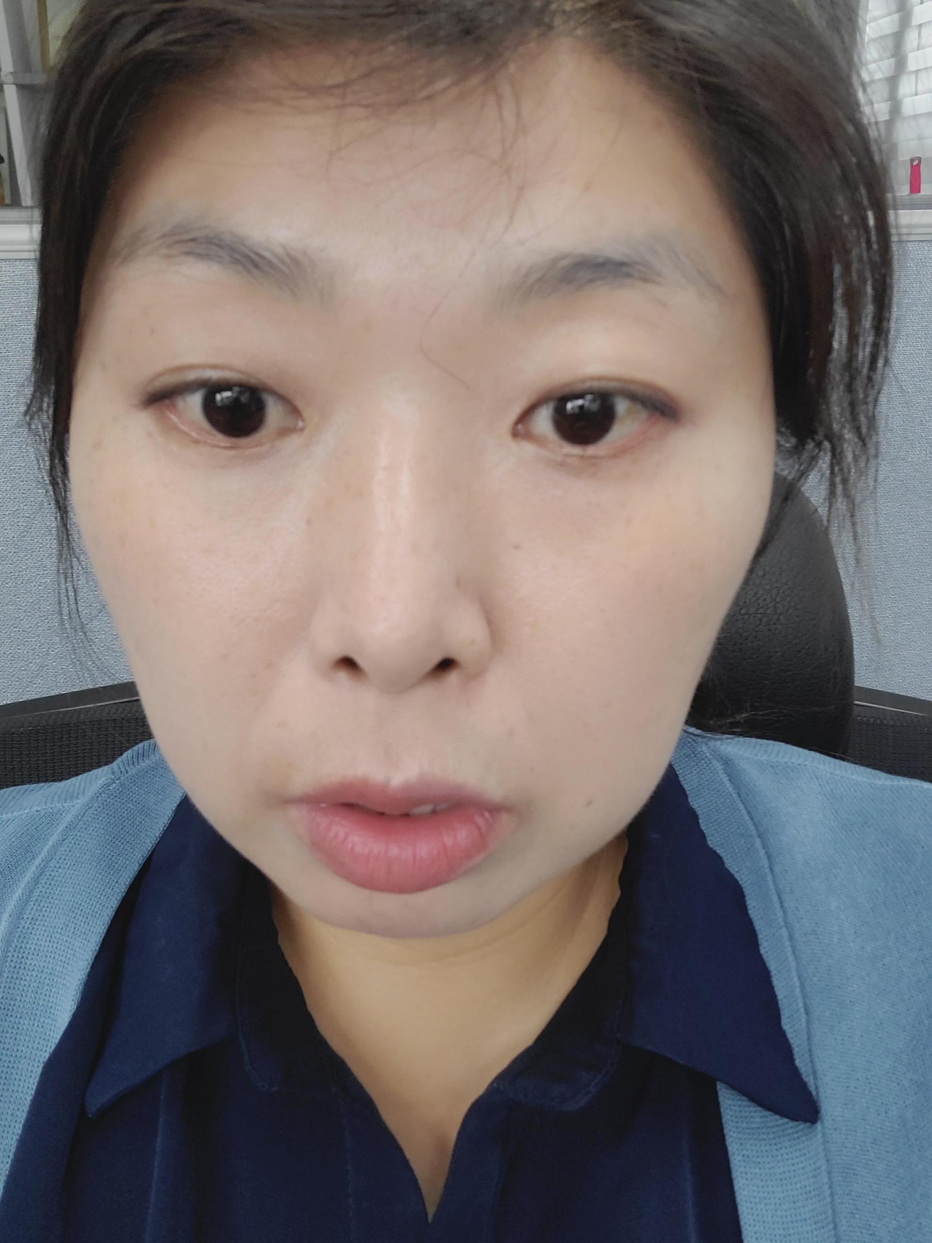 피드이미지정보-8