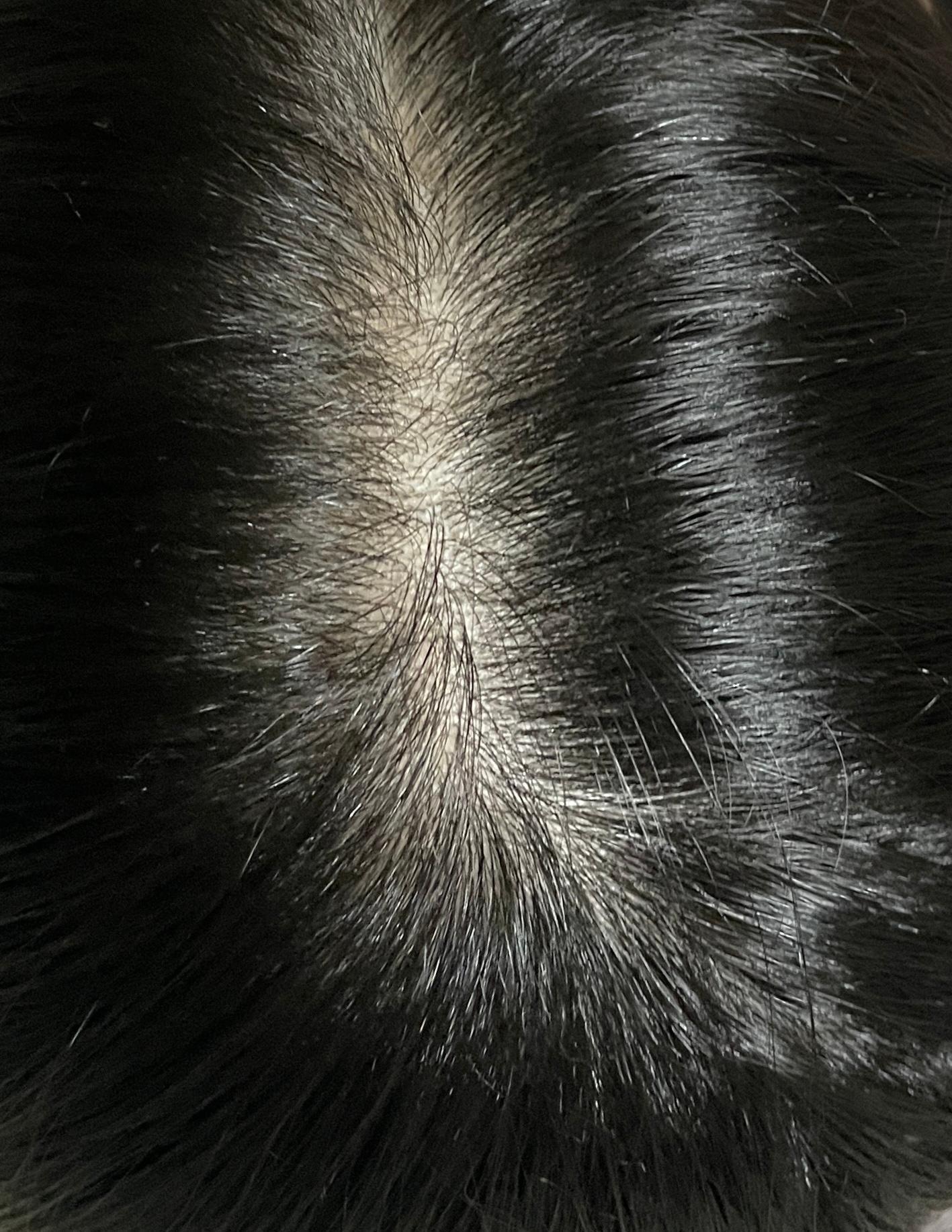 피드이미지정보-3