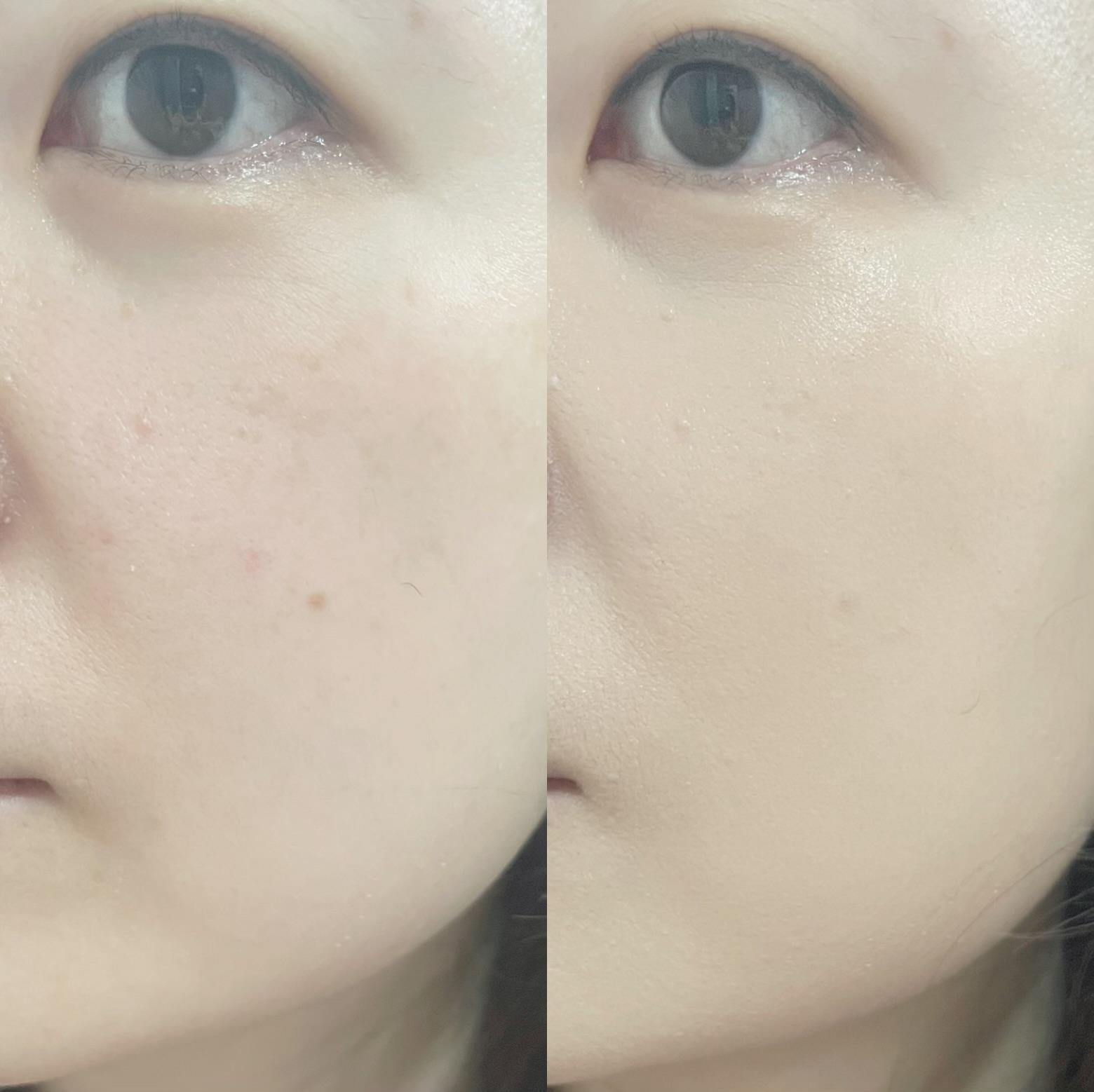 피드이미지정보-6