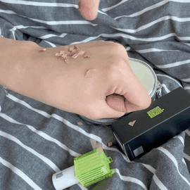 피드이미지정보-3